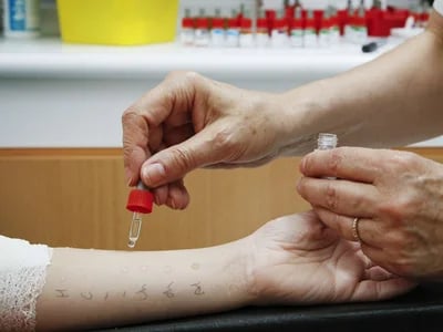 Allergietest Wien – Privat und Professionell in Ihrer HNO-Praxis