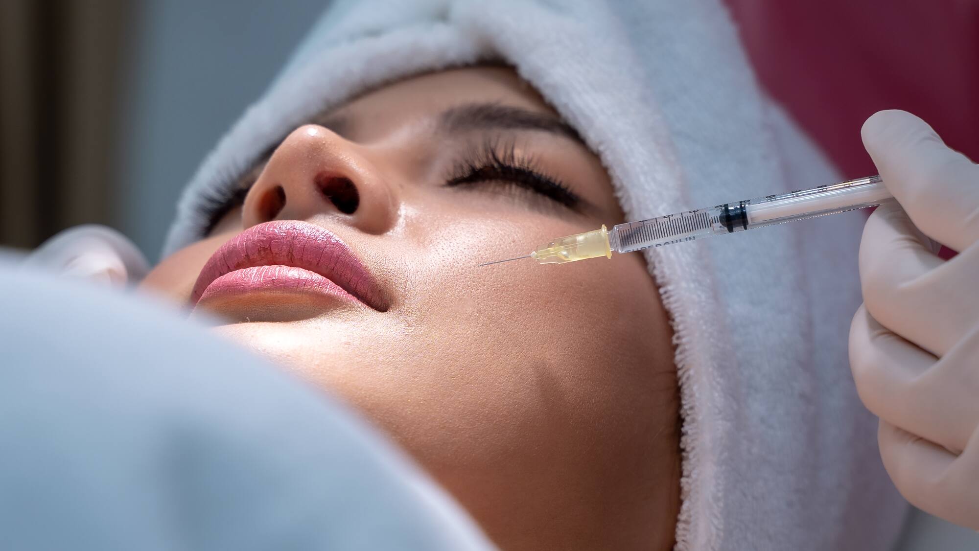 Erhöhen Sie Ihre Schönheit mit Lippen Aufspritzen Nürnberg und Hautstraffung bei MY AESTHETICS