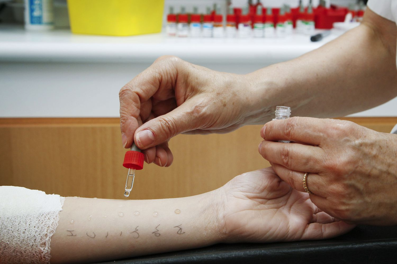Allergietest Wien – Privat und Professionell in Ihrer HNO-Praxis