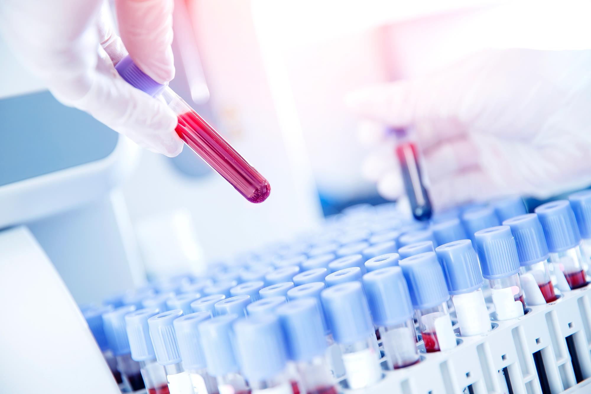 HL7 Schnittstelle und ihre Rolle in der Patientenversorgung